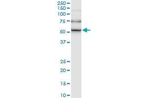 ILK monoclonal antibody (M01), clone 4F10.