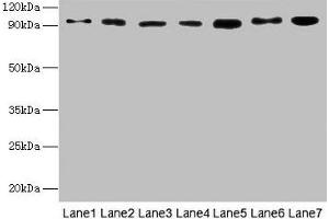 Western blot All lanes: USP5 antibody at 10 μg/mL Lane 1: Mouse brain tissue Lane 2: A549 whole cell lysate Lane 3: MCF-7 whole cell lysate Lane 4: A375 whole cell lysate Lane 5: U251 whole cell lysate Secondary Goat polyclonal to rabbit IgG at 1/10000 dilution Predicted band size: 96, 94 kDa Observed band size: 96 kDa (USP5 antibody  (C-Term))