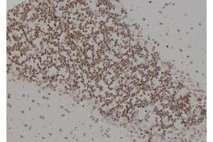 ABIN6277232 at 1/100 staining Rat brain tissue by IHC-P. (PSMC4 antibody  (C-Term))