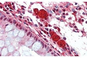 Immunohistochemistry (IHC) image for anti-Hexosaminidase B (Beta Polypeptide) (HEXB) (AA 315-456) antibody (ABIN7432289)