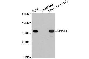 Immunoprecipitation analysis of 200ug extracts of 293T cells using 1ug MNAT1 antibody. (MNAT1 antibody)