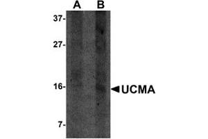 Western Blotting (WB) image for anti-Upper Zone of Growth Plate and Cartilage Matrix Associated (UCMA) (C-Term) antibody (ABIN1030790) (UCMA antibody  (C-Term))