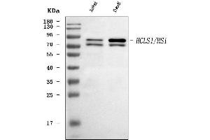 Western blot analysis of HCLS1 using anti-HCLS1 antibody (ABIN7600645).