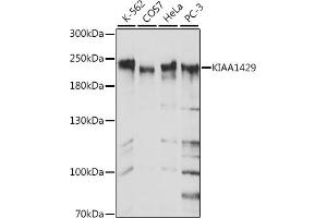 Western blot analysis of extracts of Mouse lung, using KI antibody (ABIN7269712) at 1:2080 dilution. (Protein Virilizer Homolog (VIRMA) (AA 1400-1700) antibody)