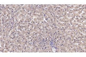 Detection of ANXA3 in Human Liver Tissue using Monoclonal Antibody to Annexin A3 (ANXA3) (Annexin A3 antibody  (AA 190-312))
