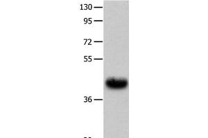 Western Blot analysis of Human fetal muscle tissue using UTS2R Polyclonal Antibody at dilution of 1:400 (UTS2R antibody)
