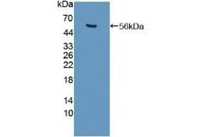 Detection of Recombinant USP7, Human using Polyclonal Antibody to Ubiquitin Specific Peptidase 7 (USP7) (USP7 antibody  (AA 54-507))