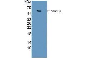 Detection of Recombinant USP7, Human using Polyclonal Antibody to Ubiquitin Specific Peptidase 7 (USP7)
