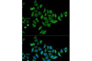 Immunofluorescence (IF) image for anti-Docking Protein 1, 62kDa (Downstream of tyrosine Kinase 1) (DOK1) antibody (ABIN7261640)