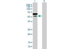 Western Blot analysis of ZNF358 expression in transfected 293T cell line by ZNF358 MaxPab polyclonal antibody. (ZNF358 antibody  (AA 1-481))