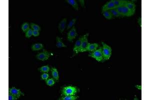 Immunofluorescent analysis of HepG2 cells using ABIN7144499 at dilution of 1:100 and Alexa Fluor 488-congugated AffiniPure Goat Anti-Rabbit IgG(H+L) (Aquaporin 1 antibody  (AA 220-269))