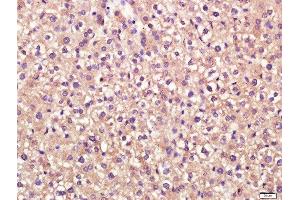 Paraformaldehyde-fixed, paraffin embedded mouse liver tissue, Antigen retrieval by boiling in sodium citrate buffer(pH6) for 15min, Block endogenous peroxidase by 3% hydrogen peroxide for 30 minutes, Blocking buffer (normal goat serum) at 37°C for 20min, Antibody incubation with Rabbit Anti-Stabilin 2 Polyclonal Antibody, Unconjugated  at 1:400 overnight at 4°C, followed by a conjugated secondary and DAB staining (Stabilin 2 (STAB2) (AA 2201-2300) antibody)