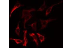 ABIN6275177 staining COLO205  cells by IF/ICC. (GNAT1 antibody  (Internal Region))
