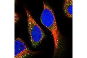 Immunofluorescent staining of human cell line U-2 OS with KCNG1 polyclonal antibody  at 1-4 ug/mL dilution shows positivity in vesicles. (KCNG1 antibody)