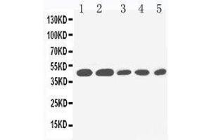 Anti-IL2 Receptor gamma antibody, Western blotting Lane 1: PANC Cell Lysate Lane 2: HELA Cell Lysate Lane 3: JURKAT Cell Lysate Lane 4: RAJI Cell Lysate Lane 5: CEM Cell Lysate