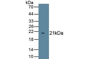 Detection of Recombinant IHH, Human using Polyclonal Antibody to Hedgehog Homolog, Indian (IHH) (Indian Hedgehog antibody  (AA 45-195))