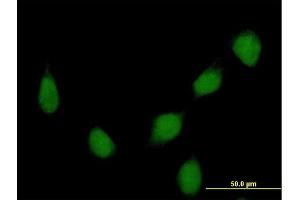 Immunofluorescence of purified MaxPab rabbit antibody to HOXB7 on HeLa cell. (HOXB7 antibody  (AA 1-217))