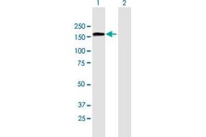 Western Blot analysis of TCOF1 expression in transfected 293T cell line by TCOF1 MaxPab polyclonal antibody. (TCOF1 antibody  (AA 1-958))