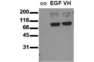 Western Blotting (WB) image for anti-Signal Transducer and Activator of Transcription 3 (Acute-Phase Response Factor) (STAT3) (pTyr705) antibody (ABIN126898)