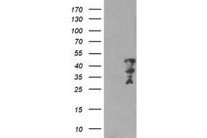Western Blotting (WB) image for anti-Myeloid Leukemia Factor 2 (MLF2) antibody (ABIN1499501) (MLF2 antibody)