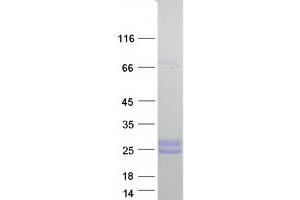 Validation with Western Blot