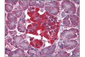 Immunohistochemistry (IHC) image for anti-14-3-3 theta (YWHAQ) (AA 1-245), (N-Term) antibody (ABIN336111) (14-3-3 theta antibody  (N-Term))