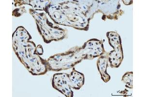 IHC analysis of HES5 using anti-HES5 antibody (ABIN7598966). (HES5 antibody  (AA 1-121))