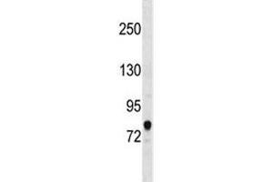 Western blot testing of human HepG2 cell lysate with ACSL3 antibody at 0. (Acsl3 antibody  (AA 12-1224))