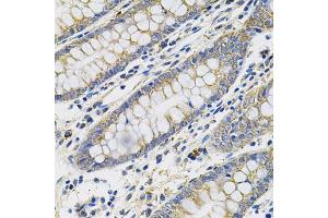 Immunohistochemistry of paraffin-embedded human colon using PGF Antibody (ABIN5970864) at dilution of 1/100 (40x lens). (PLGF antibody)