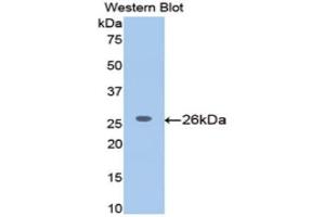 Western Blotting (WB) image for anti-Meningioma Expressed Antigen 5 (Hyaluronidase) (MGEA5) (AA 19-222) antibody (ABIN1172151) (MGEA5 antibody  (AA 19-222))