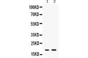 Western blot analysis of Peptide YY expression in mouse spleen extract ( Lane 1) and mouse liver extract ( Lane 2).