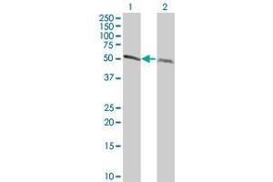 Western Blot analysis of TUBA1 expression in transfected 293T cell line by TUBA1 monoclonal antibody (M06), clone 2E9. (TUBA4A antibody  (AA 1-448))