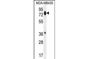PCDHB13 Antibody (Center) (ABIN655959 and ABIN2845345) western blot analysis in MDA-M cell line lysates (35 μg/lane). (PCDHB13 antibody  (AA 273-300))