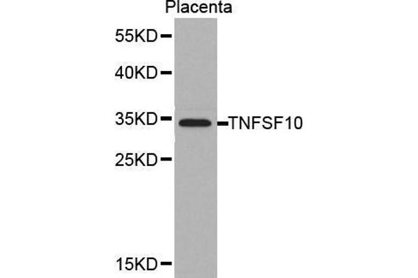 TRAIL anticorps  (AA 39-250)