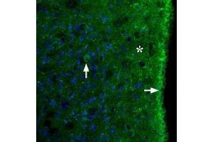 Expression of MC3R in rat brain - Immunohistochemical staining of perfusion-fixed frozen rat brain sections using Anti-MC3 Receptor (extracellular) Antibody (ABIN7043323 and ABIN7044595), (1:100). (MC3R antibody  (1st Extracellular Loop))