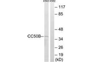 Western blot analysis of extracts from K562 cells, using TMEM30B Antibody. (TMEM30B antibody  (AA 91-140))