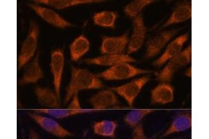 Immunofluorescence analysis of L929 cells using ME3 Polyclonal Antibody at dilution of 1:100. (ME3 antibody)