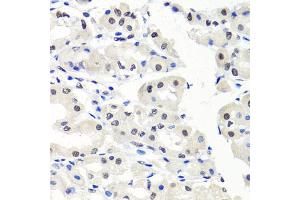 Immunohistochemistry of paraffin-embedded human stomach using CBX1 antibody (ABIN5971253) at dilution of 1/100 (40x lens). (CBX1 antibody)