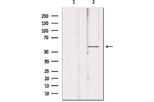 Western blot analysis of extracts from 293, using ACBD5 Antibody. (ACBD5 antibody  (Internal Region))