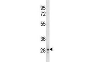 SNAI3 antibody western blot analysis in T47D lysate. (SNAI3 antibody  (AA 1-29))