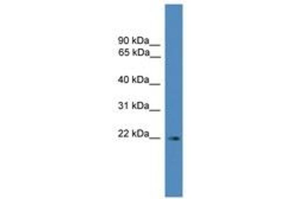 SSX3 antibody  (C-Term)