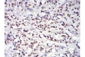 Immunohistochemistry (IHC) image for anti-Janus Kinase 2 (JAK2) (AA 745-955) antibody (ABIN5542629)