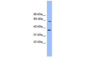 PDP2 antibody used at 1 ug/ml to detect target protein. (PDP2 antibody  (Middle Region))