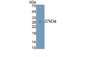 Detection of Recombinant AZU1, Human using Monoclonal Antibody to Azurocidin (AZU) (Azurocidin antibody  (AA 23-247))