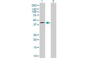 Western Blot analysis of FASN expression in transfected 293T cell line by FASN monoclonal antibody (M01A), clone 3F2-1F3. (Fatty Acid Synthase antibody  (AA 1-439))