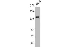 Western Blot analysis of COLO205 cells using A Cyclase V/VI Polyclonal Antibody (ADCY6 antibody  (C-Term))