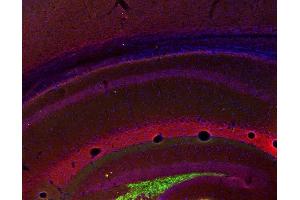 Indirect immunostaining of PFA fixed mouse hippocampus section with anti-HCN 1 (dilution 1 : 200; red) and guinea pig anti-ZnT 3 (cat. (HCN1 antibody  (AA 849-910))