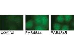 Indirect immunofluorescence analysis of GFP-PRKD3 fusion protein expression in Panc-1 cells by using PRKD3 polyclonal antibody  and PRKD3 polyclonal antibody  . (PRKD3 antibody  (C-Term))