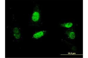 Immunofluorescence of monoclonal antibody to SURB7 on HepG2 cell. (MED21 antibody  (AA 1-144))