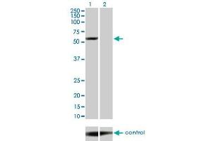 Western blot analysis of YES1 over-expressed 293 cell line, cotransfected with YES1 Validated Chimera RNAi (Lane 2) or non-transfected control (Lane 1).